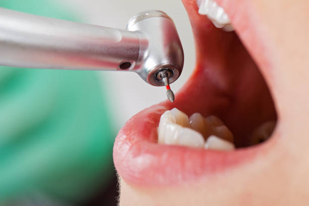 Best Emergency Treatment for Toothache in Hartford, CT
